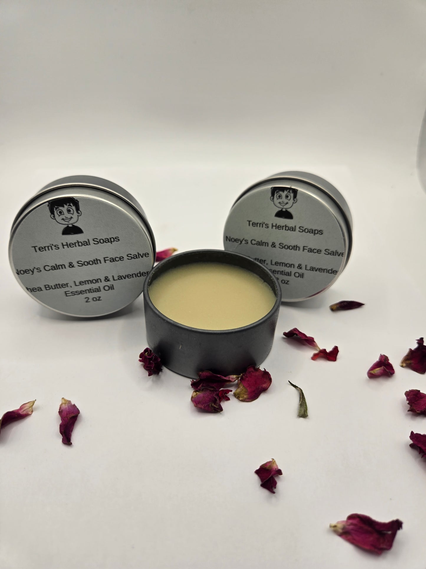 Noey's Acne Salve