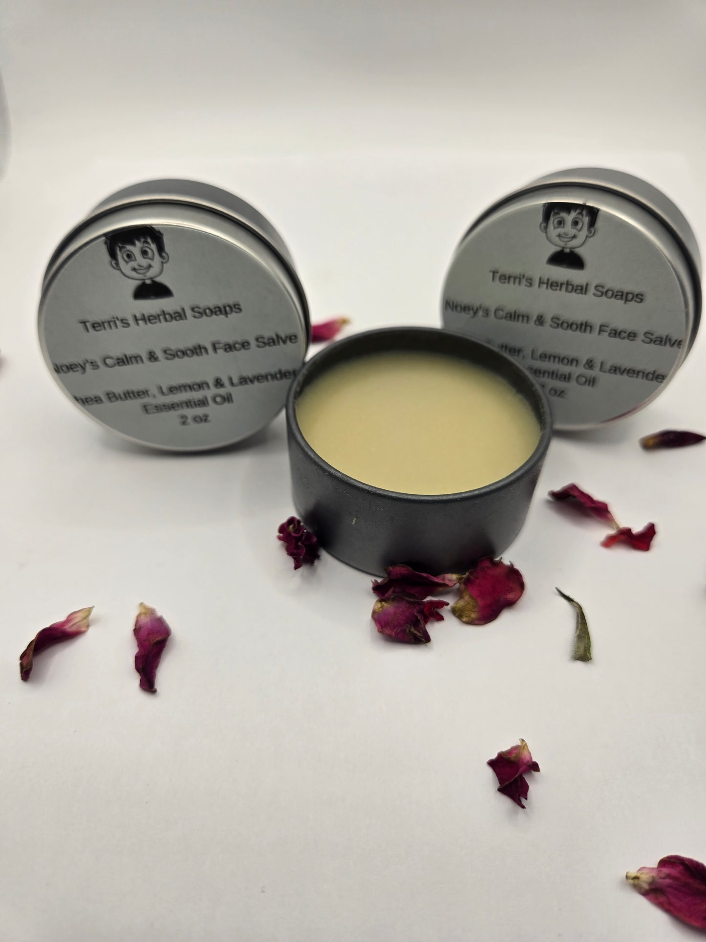 Noey's Acne Salve